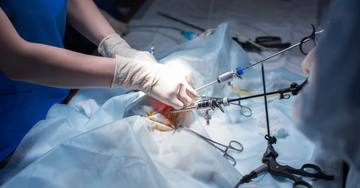 Laparoscopic Procedures